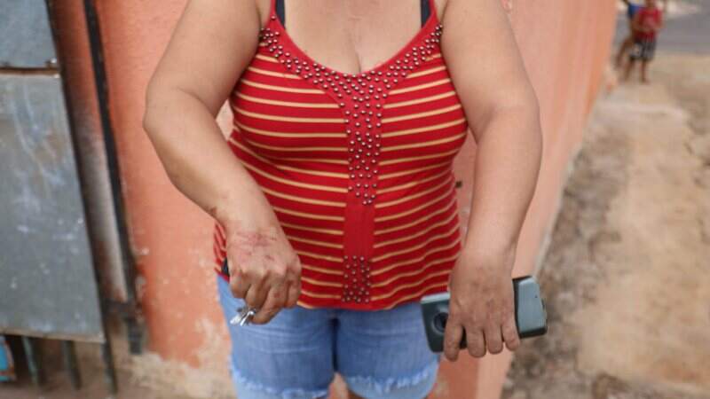 Mãe da vítima chamou filho ao ver animal sendo atacado.