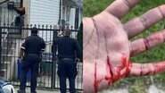 Policiais cercando o animal e mão do homem que foi atacado - (Foto: Reprodução)