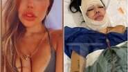 Liziane Gutierrez passa por cirurgia - Foto: Reprodução/Instagram
