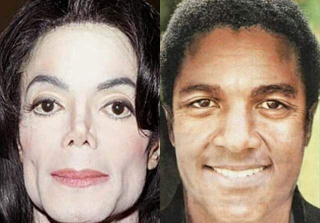 Imagem compara possível aparência de Michael Jackson sem plásticas (Reprodução)