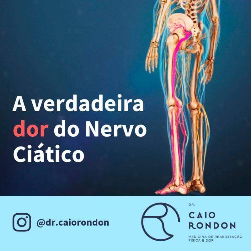 Dr. Caio Rondon, médico fisiatra, fala sobre hérnia de disco e dor no nervo ciático.