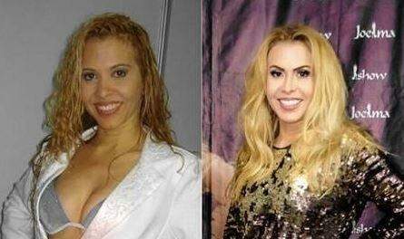 Joelma mostra antes e depois de harmonização facial e choca fãs