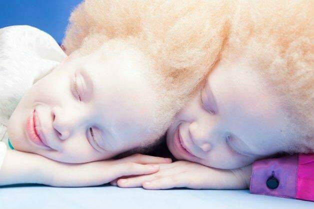 A beleza única e rara das gêmeas albinas brasileiras Mara e Lara Bawar.