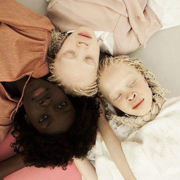 A beleza única e rara das gêmeas albinas brasileiras Mara e Lara Bawar.