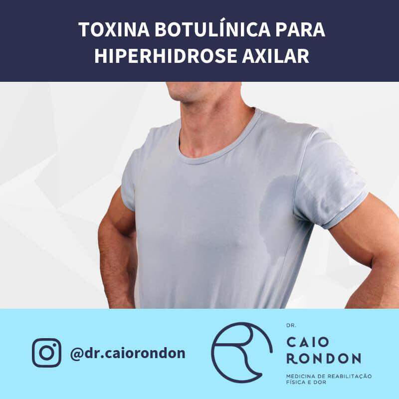 Entenda sobre a toxina botulínica para hiperhidrose axilar com Dr. Caio Rondon