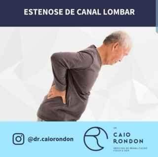 Dr. Caio Rondon fala sobre a estenose de canal lombar
