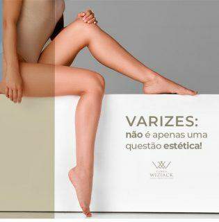 Varizes: não é apenas uma questão estética !