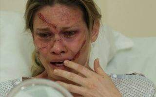 Vilã punida: Jéssica fica desfigurada e vira 'múmia' no final de Haja Coração