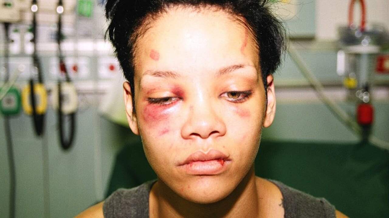 rihanna - Chris Brown é acusado mais uma vez de agressão contra mulher e será investigado