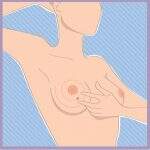 Autoexame ou mamografia? Saiba quando utilizar os meios de detecção do câncer de mama