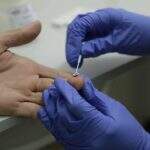Para especialista, teste da Aids deveria ser compulsório em população de MS