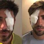 Libertadores: Jogadores do Boca ficam feridos após ataque da torcida do River