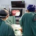 Santa Casa realiza primeira cirurgia cardiovascular videoassistida pelo SUS