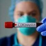 Coronavírus: estudo prevê isolamento intermitente até 2022