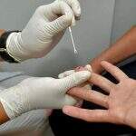 Governo suspende exames de HIV, aids e hepatites virais no SUS