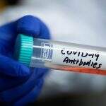 Imunidade de rebanho para controle da covid-19 é ‘falácia’, dizem cientistas