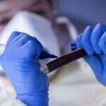 Brasil registra 69,1 mil mortes e 1,75 milhão de casos de coronavírus