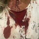 Homem corta supercílio da mulher durante agressão e deixa vítima sangrando