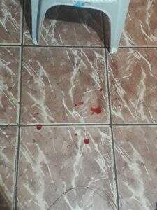 Nariz da vítima chegou a sangrar após agressão. Foto: Divulgação