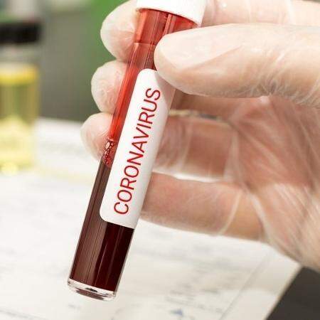 Teste de coronavírus em paciente de Itaporã deu negativo, informa secretaria de saúde