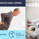 Dr. Caio Rondon fala sobre a estenose de canal lombar