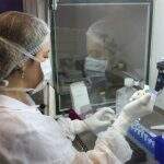 SES compra reagentes laboratoriais para o Lacen por R$ 866 mil