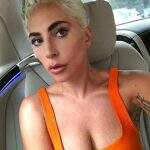 Gente como a gente! Lady Gaga posta foto com estrias e sem photoshop