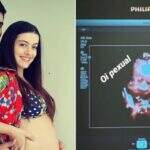 Mulher de Marcelo Adnet mostra rostinho da filha em ultrassom
