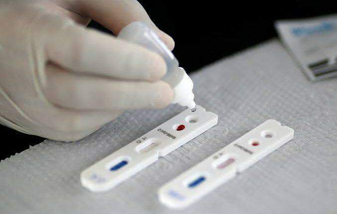 Postos de saúde de Campo Grande também farão testes rápidos de coronavírus