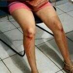Mulher é agredida com chutes nas costas e marido ameaça ‘cravar faca’ em MS
