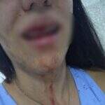 Mulher é agredida depois de flagrar esposa aos beijos com adolescente de 13 anos
