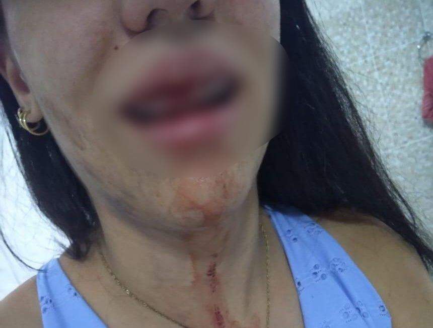Mulher é agredida depois de flagrar esposa aos beijos com adolescente de 13 anos