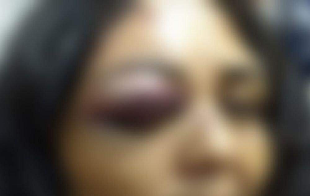 Populares socorrem mulher espancada com chutes nas costas e arrastada por marido na rua