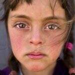 Zahra: a imagem do ano da UNICEF