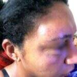 Mulher fica ferida após ser agredida com barra de ferro pelo ex-marido