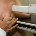 Entra em vigor lei que garante ultrassonografia mamária pelo SUS a mulheres jovens