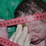 Mães de bebês com microcefalia descartada respiram aliviadas