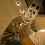 Células-tronco amenizam efeitos da radioterapia contra o câncer