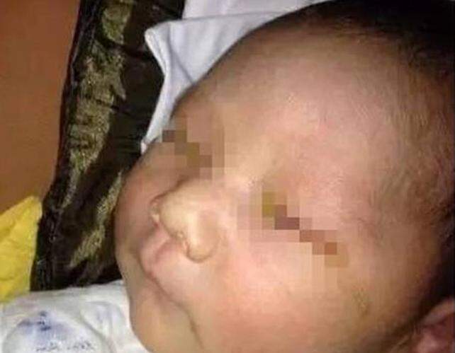 China: bebê fica parcialmente cego após amigo da família fazer foto dele com flash