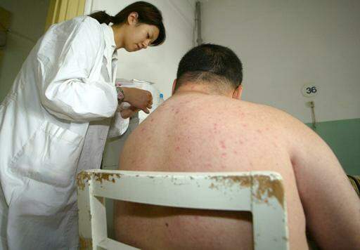 Estudo alerta sobre risco de obesidade na China