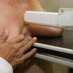 Câmara aprova projeto que assegura mamografia a mulheres a partir dos 40