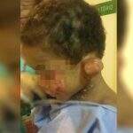 Conselho Tutelar diz que ficou 60 dias sem ver garoto torturado porque tia ‘fugia’