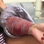 Sabrina Boing Boing sofre assalto com facadas em SP: ‘Ele me batia muito’