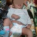 Agonia: com menos de 2 meses de vida, bebê luta para conseguir cirurgia no SUS