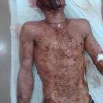 ‘Ladrão do blindex’: suspeito de 12 roubos é espancado e queimado por populares