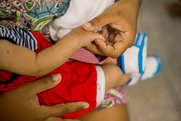 Infecção por zika traz problemas a 1/3 dos bebês e em qualquer fase da gravidez