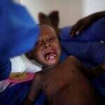 Haiti registra quase 800 casos de cólera após passagem de Matthew