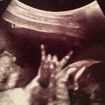 Feto faz sinal de ‘mão-chifrada’ em ultrassom e deixa pais orgulhosos