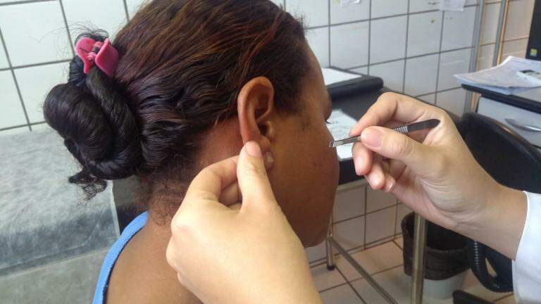 Aplicação de sementes em pontos da orelha (Foto: Divulgação/Sesau)