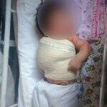 Bebê tem fratura na clavícula durante parto e família reclama de maternidade